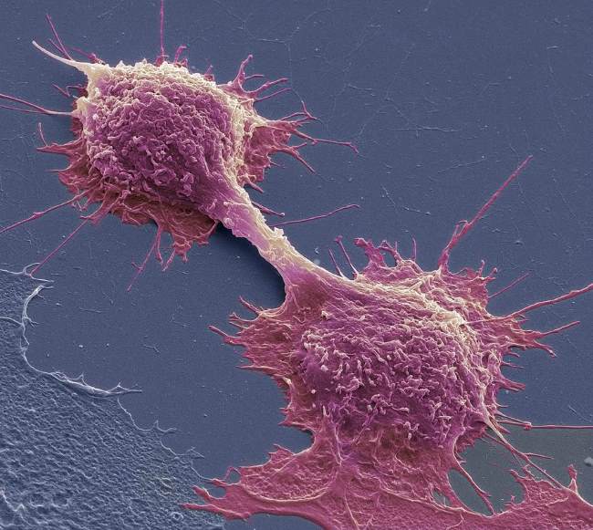Деление раковых клеток